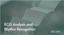 ECG Analysis and Rhythm Recognition